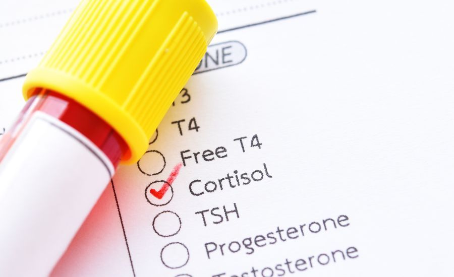 What Is Cortisol Detox and How To Do It To Reduce Stress Levels.jpg