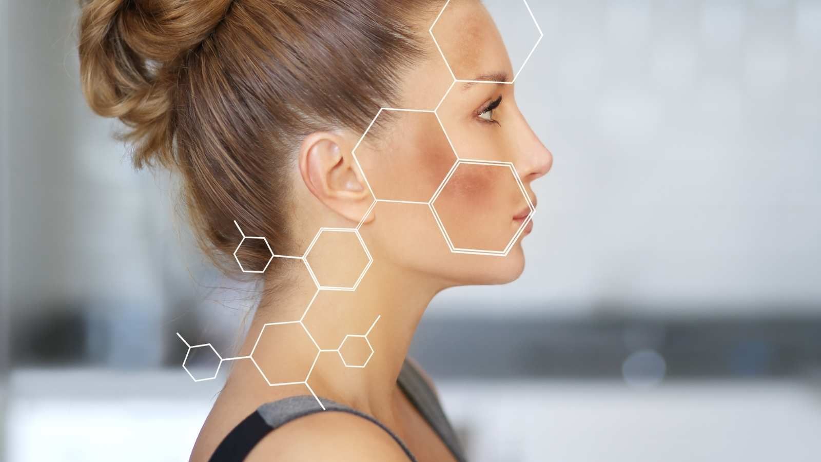 Decoding Hyperpigmentation: The Signs & Solutions for Even-Toned Skin