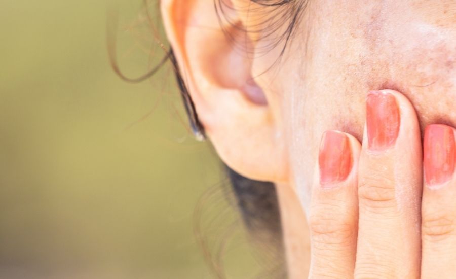 how to deal with hyperpigmentation