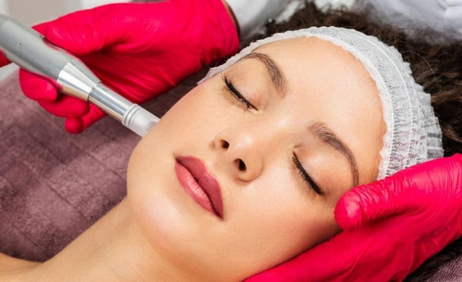 how to deal with hyperpigmentation